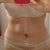 post op day 14