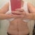 post op 4 weeks