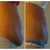 5 day post / 14 day post other side