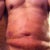 1st day after lipo, completely relaxed