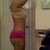 15 days post op wanted a much bigger projection