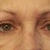 eyes