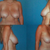 Before pictures