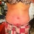 Getting better. Less swollen and the opening is getting smaller.