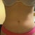 Tummy up close