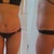 Week 4. Oh, yes! THE bikini! And no scar in sight! I am so thankful for my PS's masterful scar placement!  My lower tummy is very firm and round, still quite swollen. But I feel very good.