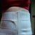 Compression garment prescribed by PS