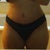 17 days post op