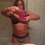1 year post op abs