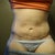 My incision is getting lighter!  I am still not using any scar treatment as of yet.  The wrinkle you see leading up to my belly button is from the compression garment.