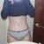 26 days post op