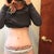 26 days post op. The incision looks so red because I still have a glue-type strip over the incision that hasn't peeled off yet. There is dried blood and whatnot stuck under it so that's why the incision looks like that. Doc told me not to "pull" it off, just let it fall and flake off naturally. I guess it likes being on my belly :0(