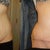 look at where the mole was before/after!! crazy!!