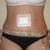 My incision comes further over on my right side, not sure why.