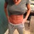 7 months post op