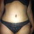 notice the visible scar below the panty line