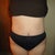9 weeks Post Op