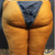 Back thighs pre (post tummy which is where the left swelling is from)