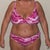 33 Days Post OP