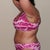 33 Days Post Op