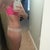 7 months post op. excuse the blotchines..fake tan is wearing off! lol
