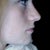 something like what im hoping for, same nose, same size just take that damn bump away!