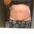 9 weeks 1 day. Seems to be more swollen than the 4 week pic. What in the world?