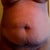 Front belly...lots of stretch marks, ugh!