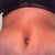 Close up of two weeks post op belly button
