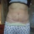 11 weeks po