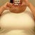 Before surgery in bra and tank top