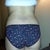 This is before my surgery... big love handles