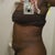 Side view 2 week post op