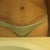 scar at 3 weeks.  Still using Kelo-cote.  The swelling around my scar never goes away. My belly button seems to be pretty much all healed up.  I like how it looks.