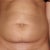 Before tummy