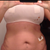 About 4 days post-op.