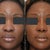 Where's the Black Representation in Cosmetic Before and After Photos?