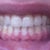 Without Trays #14 in:
I don't know why the lighting made some of my teeth look yellow in these photos, ugh.. they're not yellow in real life LOL