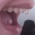 I don't know why the lighting made some of my teeth look yellow in these photos, ugh.. they're not yellow in real life LOL