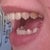 I don't know why the lighting made some of my teeth look yellow in these photos, ugh.. they're not yellow in real life LOL