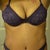 6 weeks post opt! Purple rain! Purple rain!