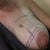 Day of surgery - All drawn on