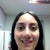 After-7 weeks, notice on left side of pic as I'm smiling how my nose appears as if its curving