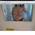 Sneeked off to toilet to take photos before surgery!!!!