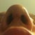 Nostrils still uneven but a tad bit better than yesterday!