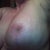 Left breast