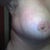 Right breast