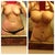Before and 7 days post op