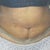 5 weeks post tt