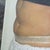 5 weeks post tt